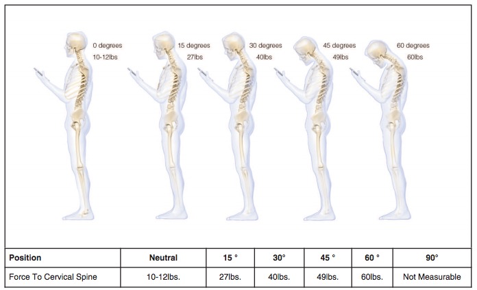 Text Neck